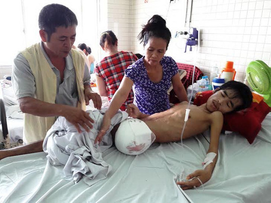 Anh Nguyễn Hữu Lợi đang được điều trị tại Bệnh viện Chợ Rẫy